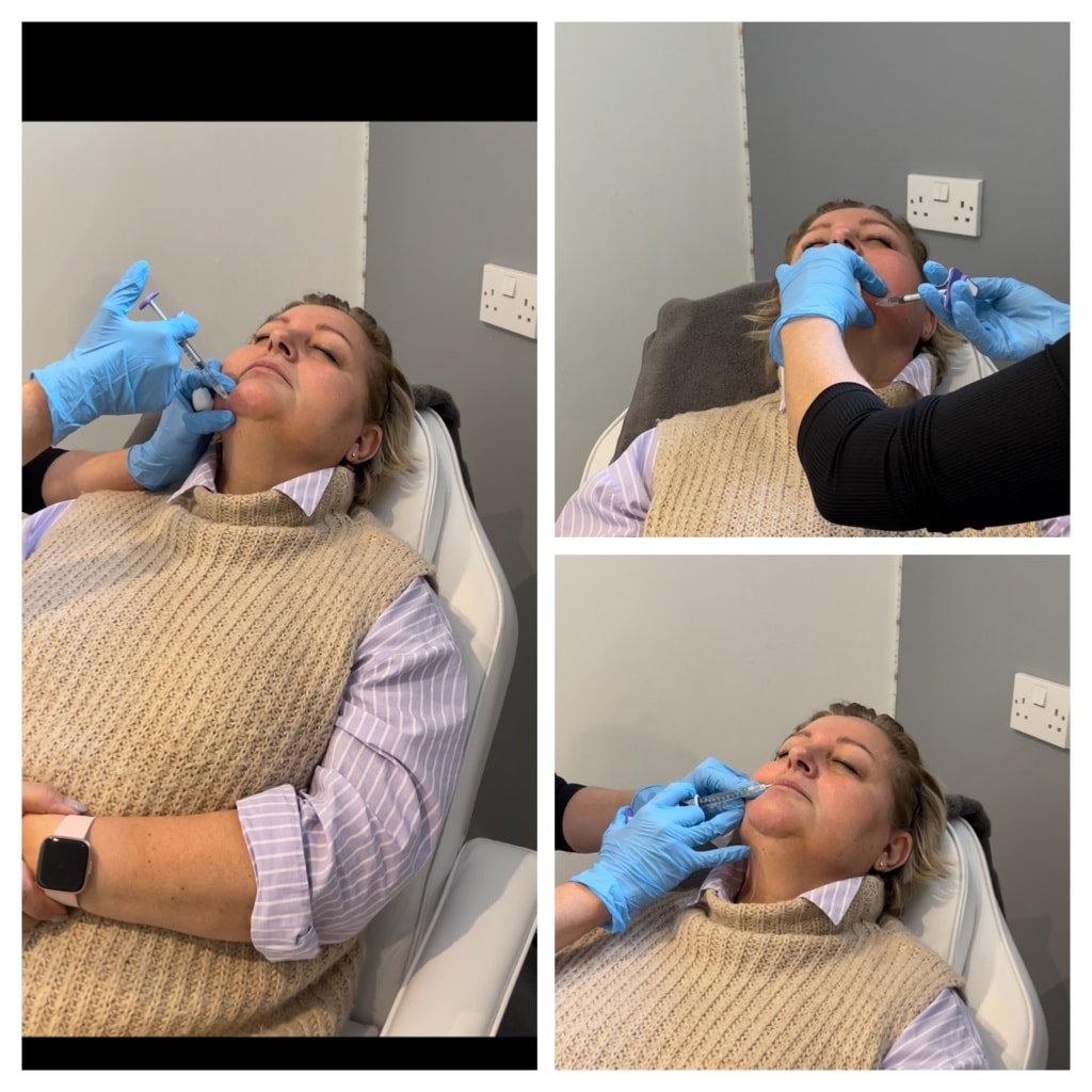 Anti-Wrinkle Injections